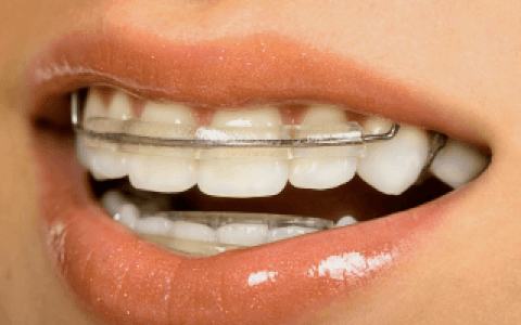 Применение ортодонтической пластины