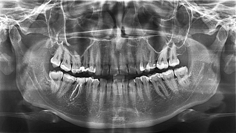 диагностика в стоматологии