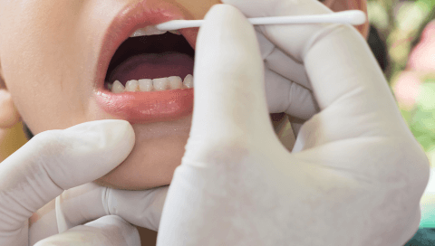 Фторирование молочных зубов