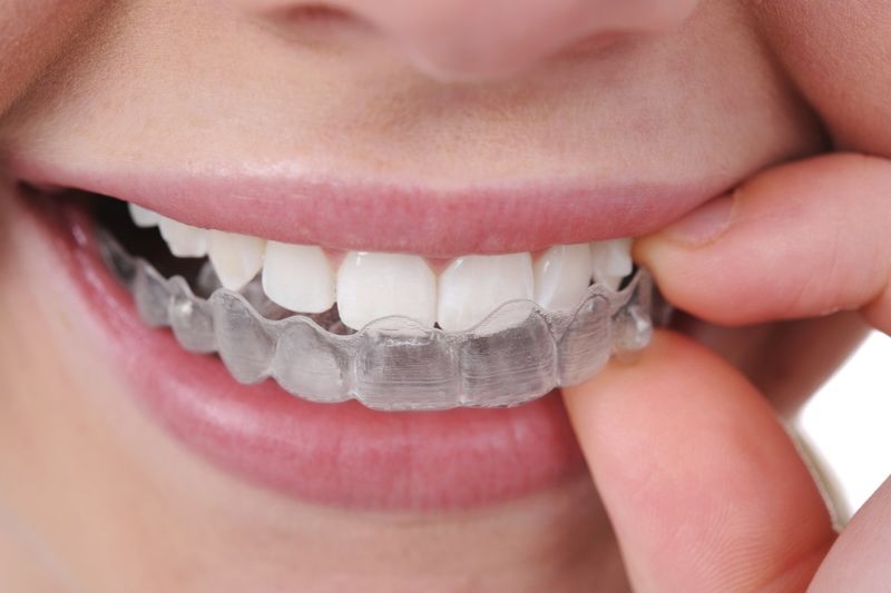 Укрепление эмали и зубов